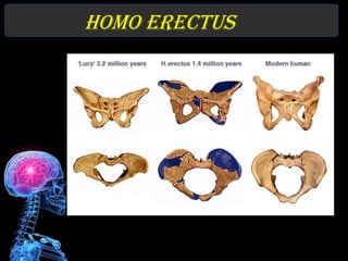 Homo erectus
 
