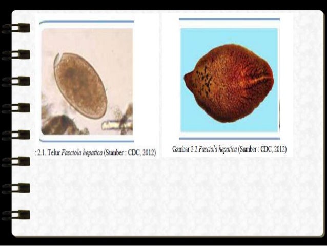 100 Gambar Telur Cacing Fasciola Hepatica Paling Keren 100 Gambar Telur Cacing Fasciola Hepatica Paling Keren