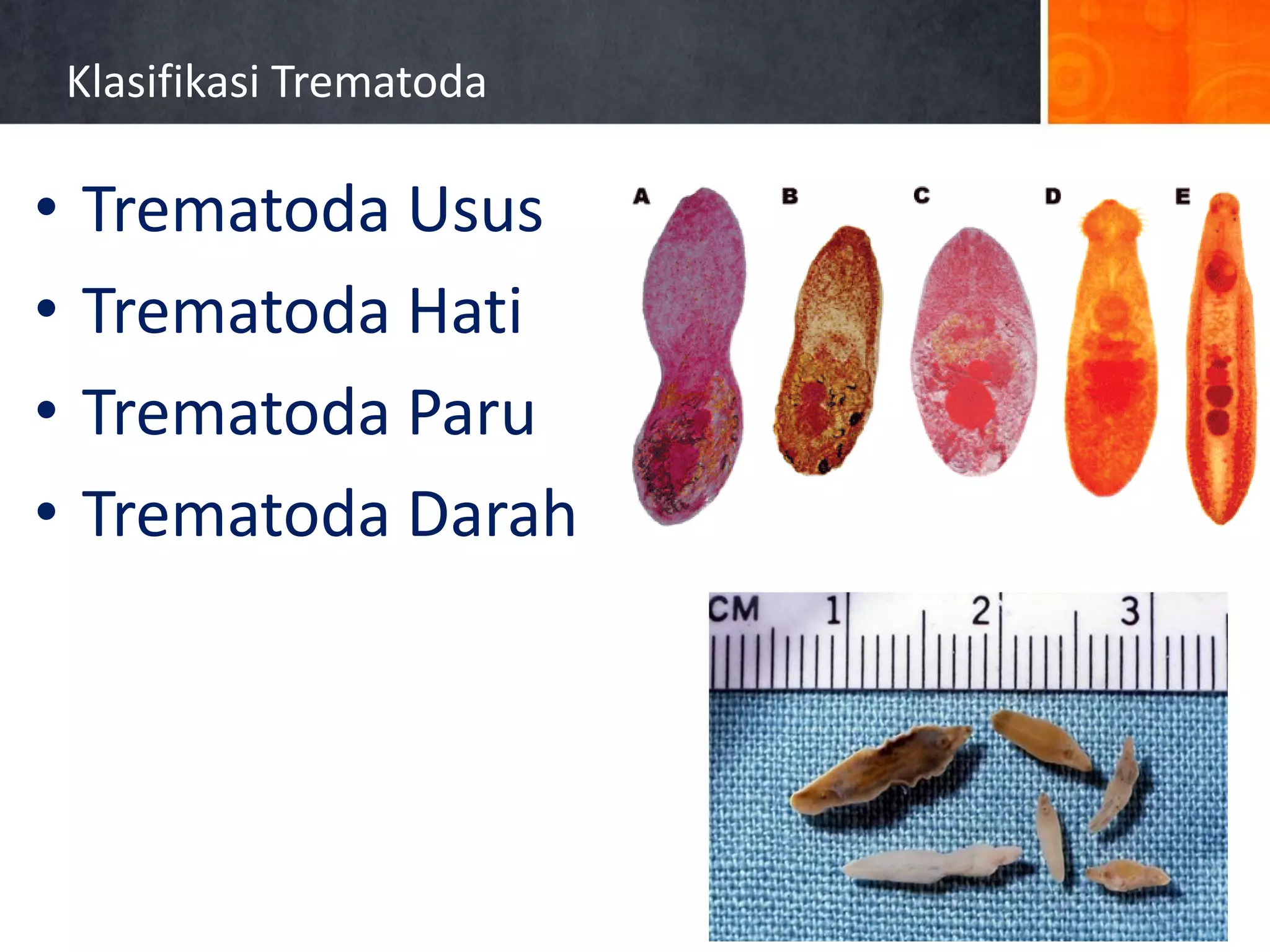 Trematoda pbl8