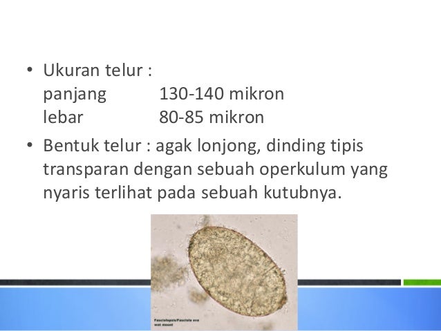 80 Gambar Telur Cacing Fasciolopsis Buski Paling Bagus 80 Gambar Telur Cacing Fasciolopsis Buski Paling Bagus