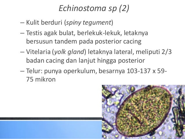 80 Gambar Telur Cacing Fasciolopsis Buski Paling Bagus 80 Gambar Telur Cacing Fasciolopsis Buski Paling Bagus