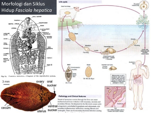 80 Gambar Telur Cacing Fasciolopsis Buski Paling Bagus 80 Gambar Telur Cacing Fasciolopsis Buski Paling Bagus