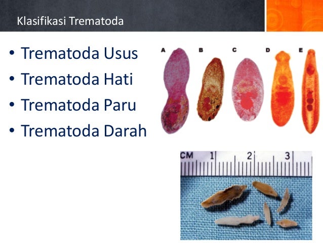 Trematoda pbl8