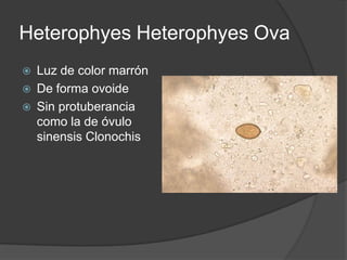 Heterophyes Heterophyes Ova
   Luz de color marrón
   De forma ovoide
   Sin protuberancia
    como la de óvulo
    sinensis Clonochis
 