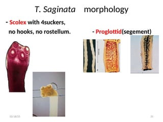 T. Saginata morphology
- Scolex with 4suckers,
no hooks, no rostellum. - Proglottid(segement)
31
02/18/25
 