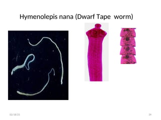 Hymenolepis nana (Dwarf Tape worm)
39
02/18/25
 