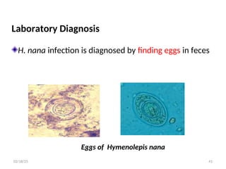 Laboratory Diagnosis
H. nana infection is diagnosed by finding eggs in feces
Eggs of Hymenolepis nana
41
02/18/25
 