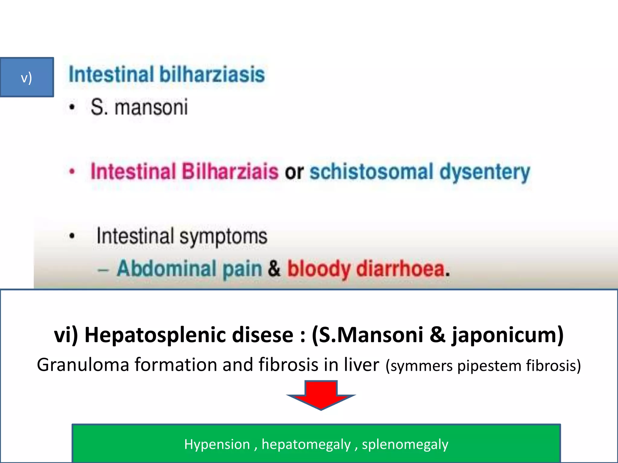 v)
vi) Hepatosplenic disese : (S.Mansoni & japonicum)
Granuloma formation and fibrosis in liver (symmers pipestem fibrosis)
Hypension , hepatomegaly , splenomegaly
 