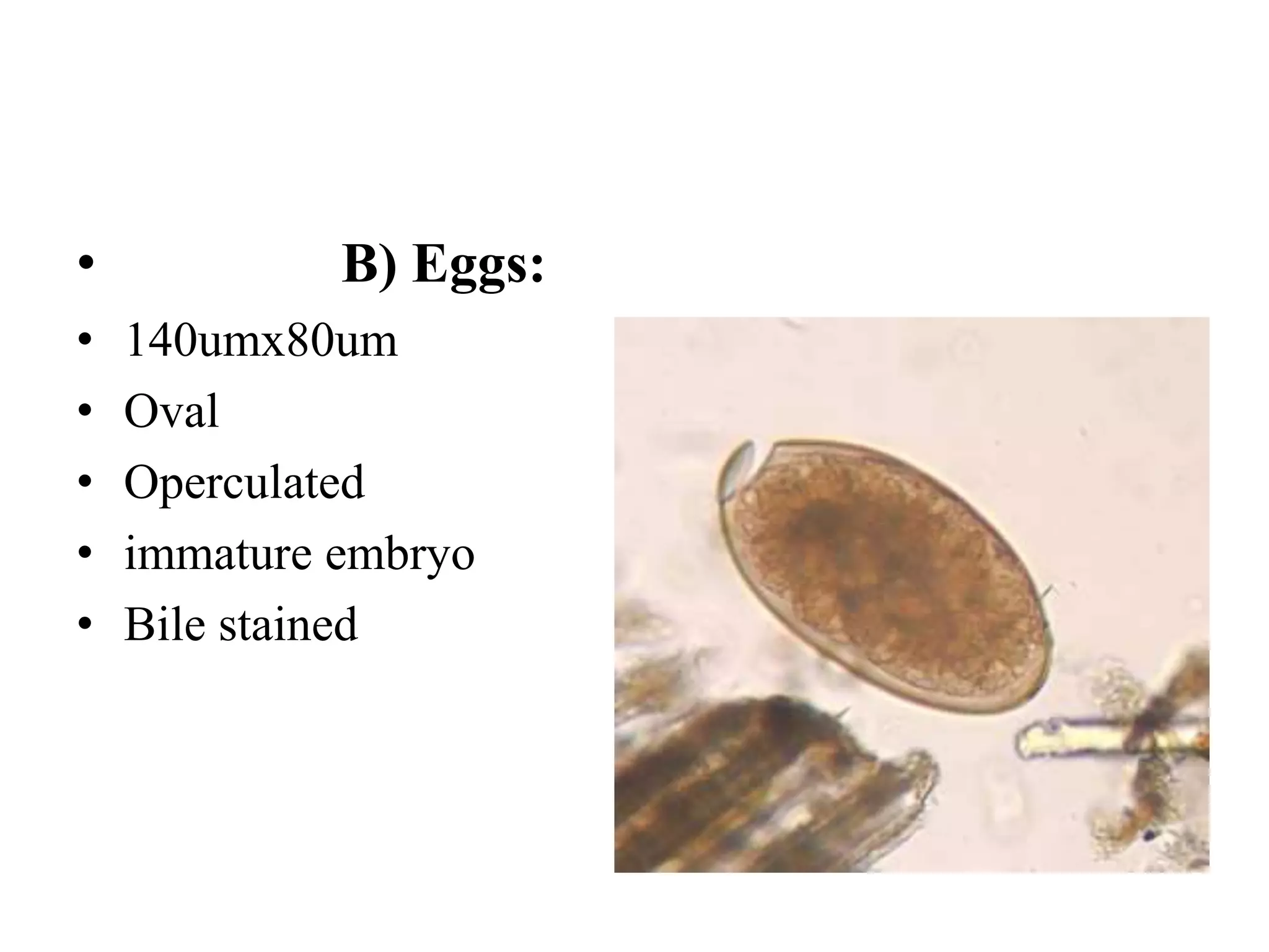 • B) Eggs:
• 140umx80um
• Oval
• Operculated
• immature embryo
• Bile stained
 
