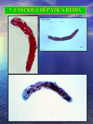 FASCIOLA HEPATICA REDIA