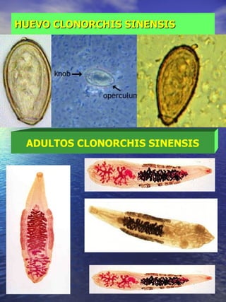 HUEVO CLONORCHIS SINENSIS ADULTOS CLONORCHIS SINENSIS