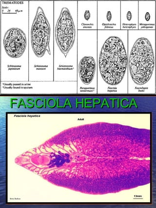 FASCIOLA HEPATICA