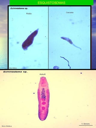 ESQUISTOSOMAS