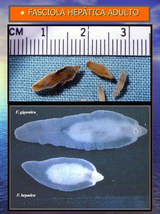 FASCIOLA HEPÁTICA ADULTO