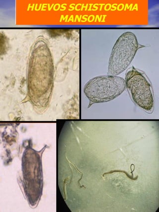 HUEVOS SCHISTOSOMA MANSONI