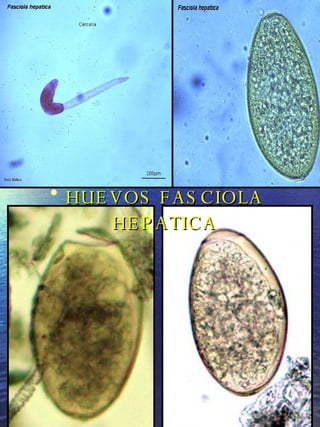 HUEVOS FASCIOLA HEPATICA
