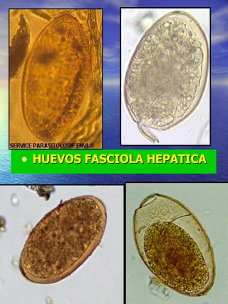 HUEVOS FASCIOLA HEPATICA