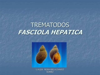L.A.Q.B. ROSA ISELA CHAVEZ
GOMEZ
TREMATODOS
FASCIOLA HEPATICA
 