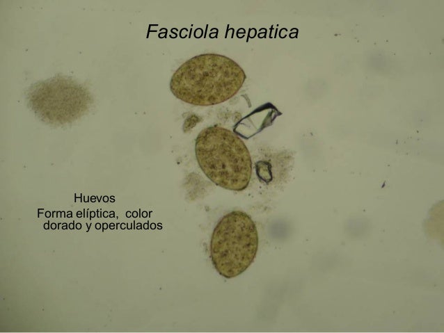 Resultado de imagen para huevos de fasciola hepatica