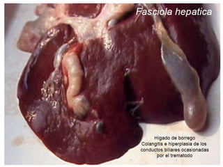 PATOGENIA.Larvas: destruyen Cs. HepáticasAdultas: Fibrosis y calcificación conductos biliares, Colangitis hiperplasica ---- hipoalbuminemia. 