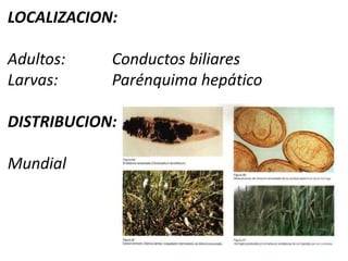  Dolor localizado en cuadrante superior derecho