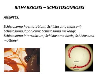 MORFOLOGIA:Cuerpo piriforme y cóncavo ventralmente