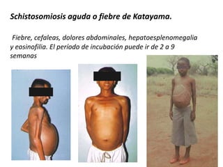 DISTRIBUCION:  MundialCICLO BIOLOGICO.Similar al de la Fasciola hepática.fases: huevo – miracidio – esporocisto – redia – cercaría – metacercaria. “H” ingiere metarcercarias, se desenquistan en duodeno.      