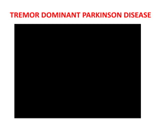 TREMOR DOMINANT PARKINSON DISEASE
 