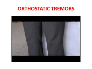 ORTHOSTATIC TREMORS
 
