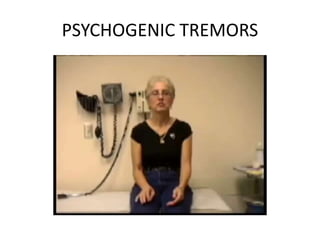 PSYCHOGENIC TREMORS
 