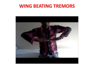 WING BEATING TREMORS
 