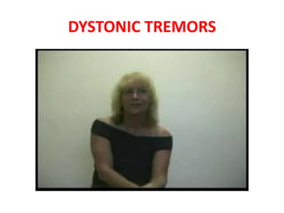 DYSTONIC TREMORS
 