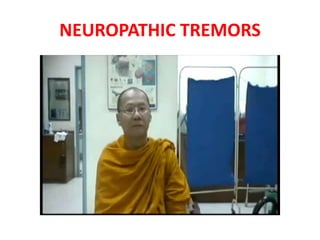 NEUROPATHIC TREMORS
 