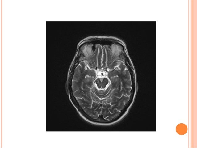 Cialis generico farmacia tamburrini castel di lama