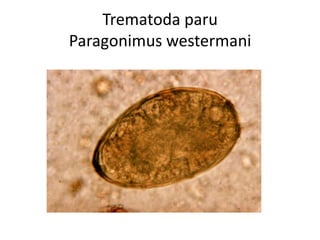 Trematoda paru
Paragonimus westermani

 