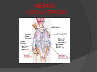 MENISC              LOCALITZACIO