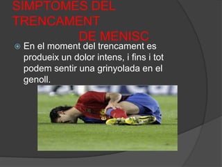 SIMPTOMES DEL TRENCAMENT                   DE MENISCEn el moment del trencament es produeix un dolor intens, i fins i tot podem sentir una grinyolada en el genoll.