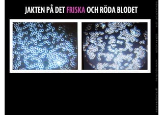 JAKTEN PÅ DET FRISKA OCH RÖDA BLODET
 