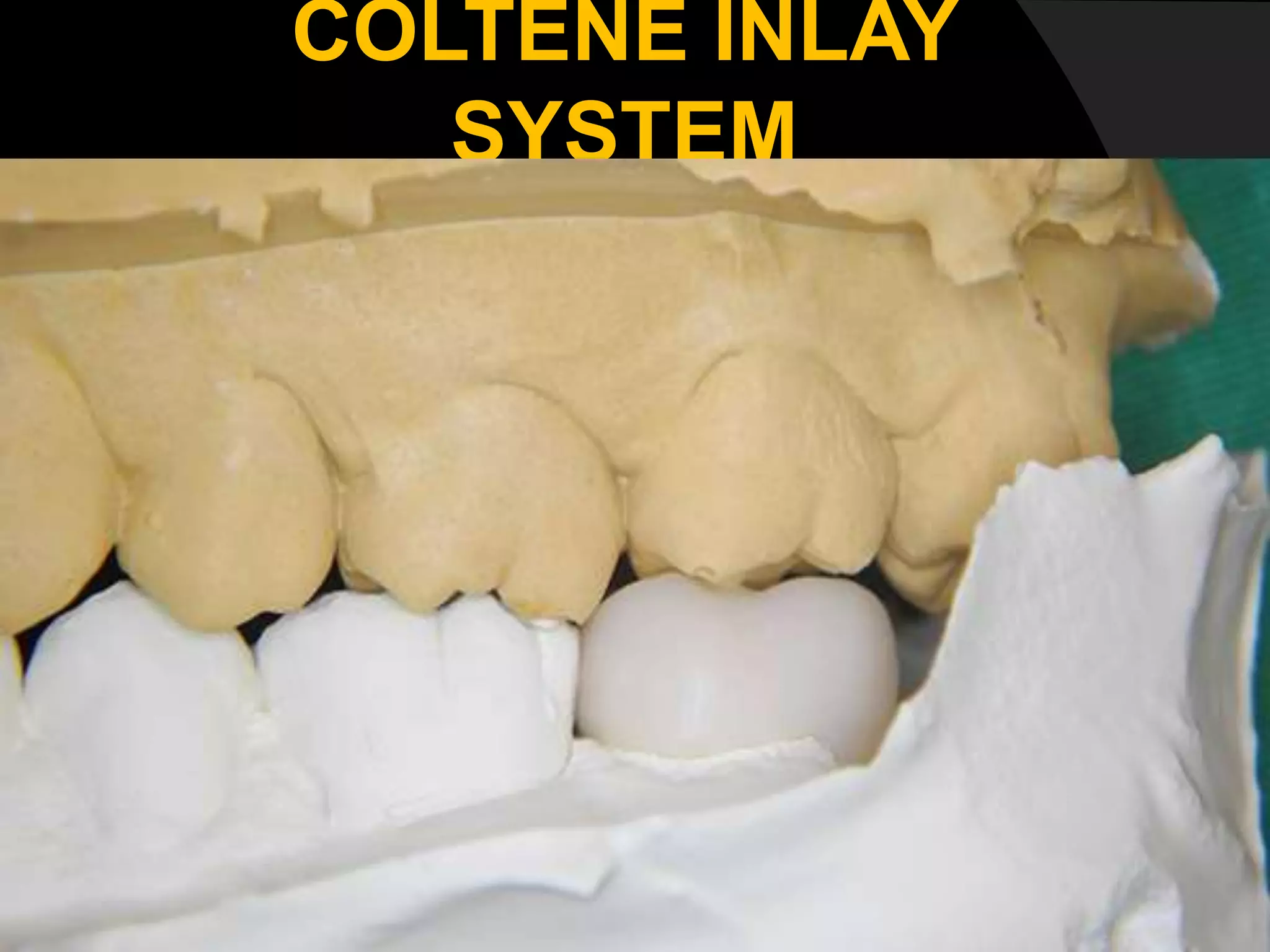 COLTENE INLAY
SYSTEM
 