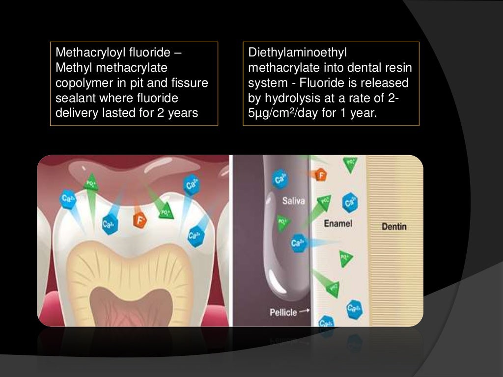 Recent advances in composite dentistry