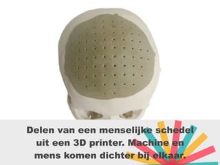 Delen van een menselijke schedel
uit een 3D printer. Machine en
mens komen dichter bij elkaar.
 