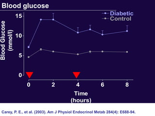 Blood glucose
                15                                            Diabetic
                                                              Control
Blood Glucose
   (mmol/l)



                10


                 5


                 0
                     0        2            4             6             8
                                         Time
                                        (hours)
  Carey, P. E., et al. (2003). Am J Physiol Endocrinol Metab 284(4): E688-94.
 