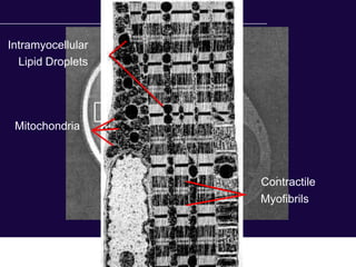 Intramyocellular
  Lipid Droplets




 Mitochondria



                   Contractile
                   Myofibrils
 