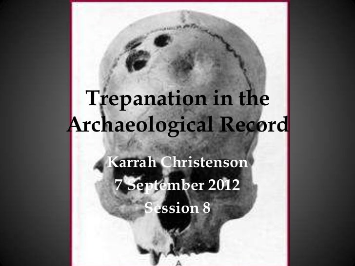 Trepanation Presentation by Karrah Christenson Session 8 2012