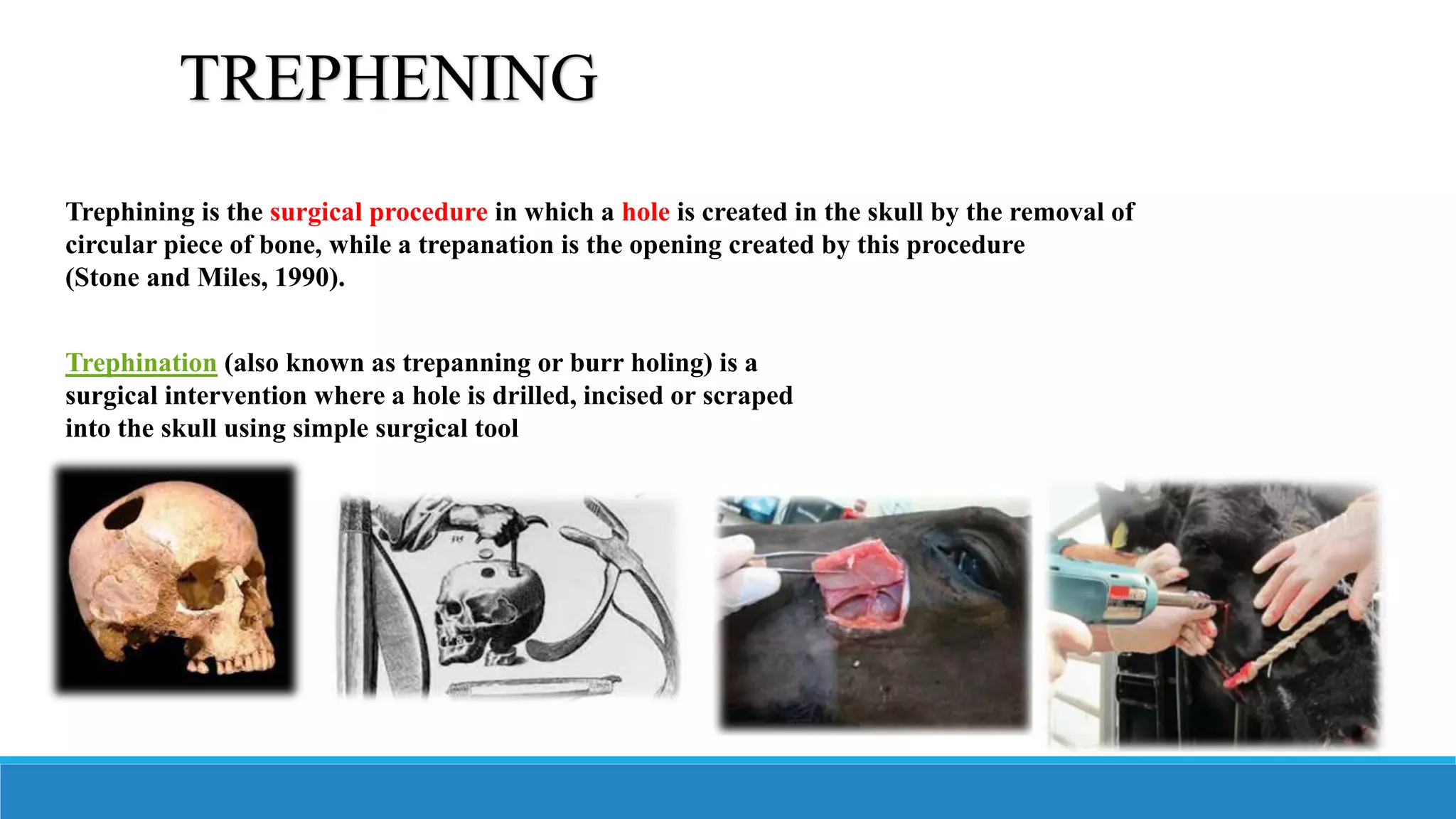 Trephining pptx Trephining pptx