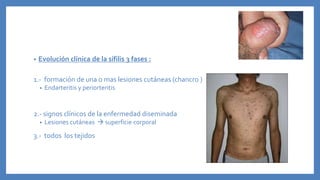 • Evolución clínica de la sífilis 3 fases :
1.- formación de una o mas lesiones cutáneas (chancro )
• Endarteritis y periorteritis
2.- signos clínicos de la enfermedad diseminada
• Lesiones cutáneas  superficie corporal
3.- todos los tejidos
 