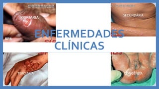 ENFERMEDADES
CLÍNICAS
 