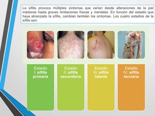La sífilis provoca múltiples síntomas que varían desde alteraciones de la piel
indoloras hasta graves limitaciones físicas y mentales. En función del estadio que
haya alcanzado la sífilis, cambian también los síntomas. Los cuatro estadios de la
sífilis son:
Estadio
I: sífilis
primaria
Estadio
II: sífilis
secundaria
Estadio
III: sífilis
latente
Estadio
IV: sífilis
terciaria
 
