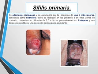 Sífilis primaria.
Es altamente contagiosa y se caracteriza por la aparición de una o más úlceras,
conocidas como chancros; éstos se localizan en los genitales o en otras zonas de
contacto, presentan un diámetro de 0.3 a 3 cm, generalmente son indoloros y sus
bordes suelen liberar una secreción serosa poco abundante.
 
