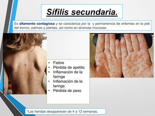 Sífilis secundaria.
Es altamente contagiosa y se caracteriza por la y permanencia de eritemas en la piel
del tronco, palmas y plantas, asi como en diversas mucosas.
*Las heridas desaparecen de 4 a 12 semanas.
• Fiebre
• Pérdida de apetito
• Inflamación de la
faringe
• Inflamación de la
laringe
• Pérdida de peso
 